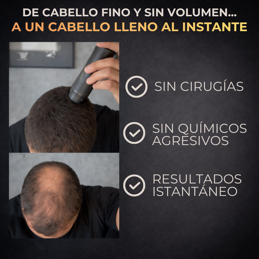 FIBRAS CAPILARES PARA LA CALVICIE DEXE®