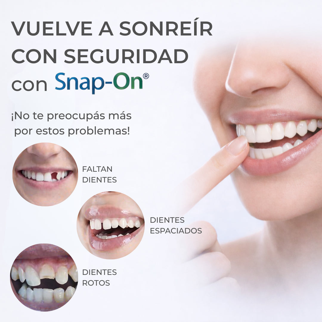 SNAP-ON SMILE® CARILLAS DENTALES REMOVIBLES