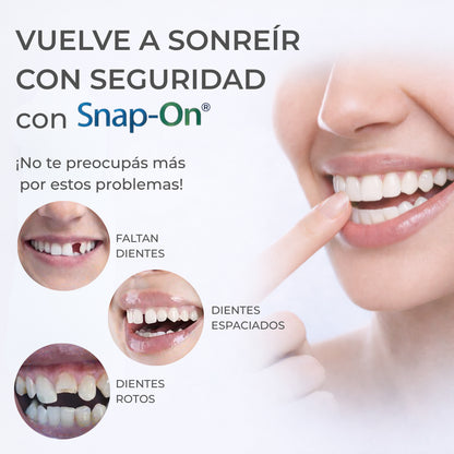 SNAP-ON SMILE® CARILLAS DENTALES REMOVIBLES