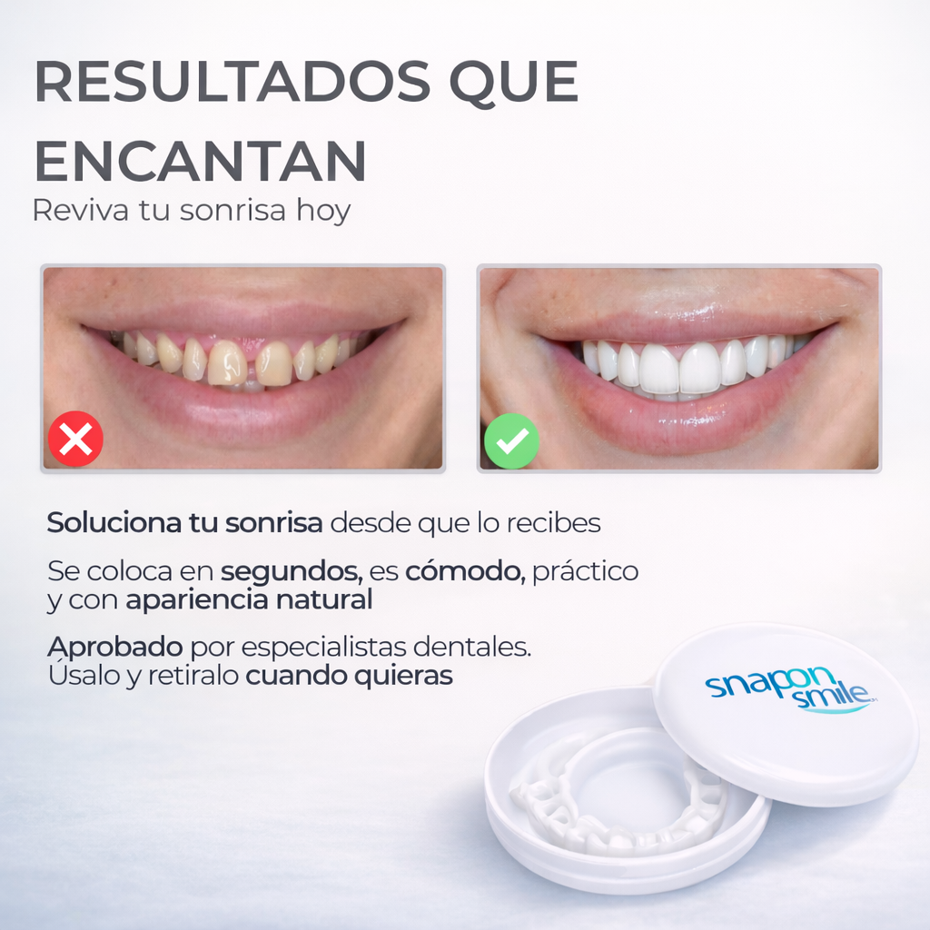 SNAP-ON SMILE® CARILLAS DENTALES REMOVIBLES