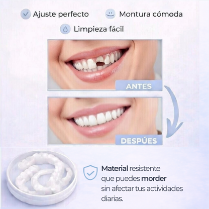 SNAP-ON SMILE® CARILLAS DENTALES REMOVIBLES