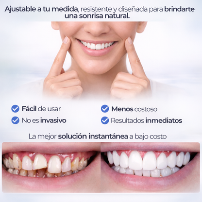 SNAP-ON SMILE® CARILLAS DENTALES REMOVIBLES